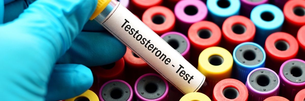 Testosteron Seviyesini Destekleyen Hobi Önerileri